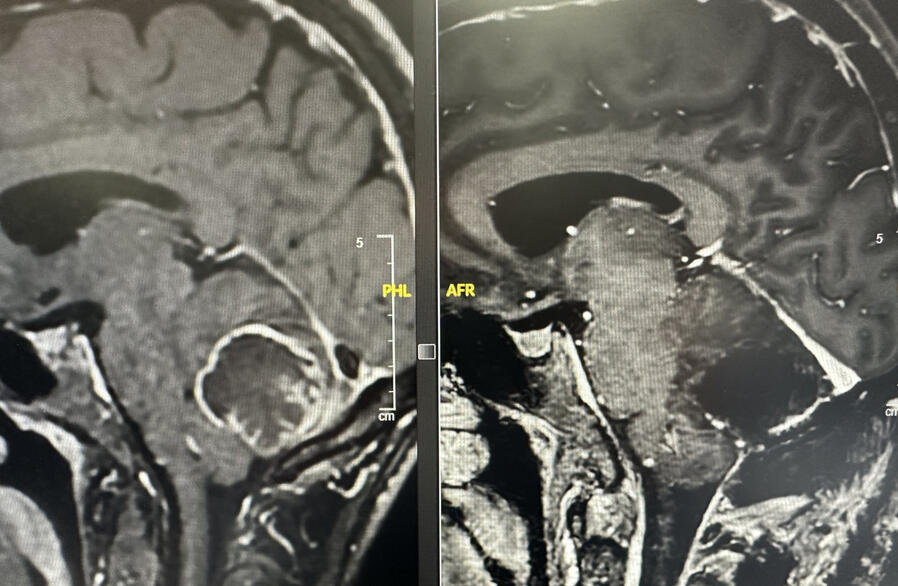 La Sociedad Española de Neurocirugía (SENEC) NEUROCIRUJANO ALICANTE