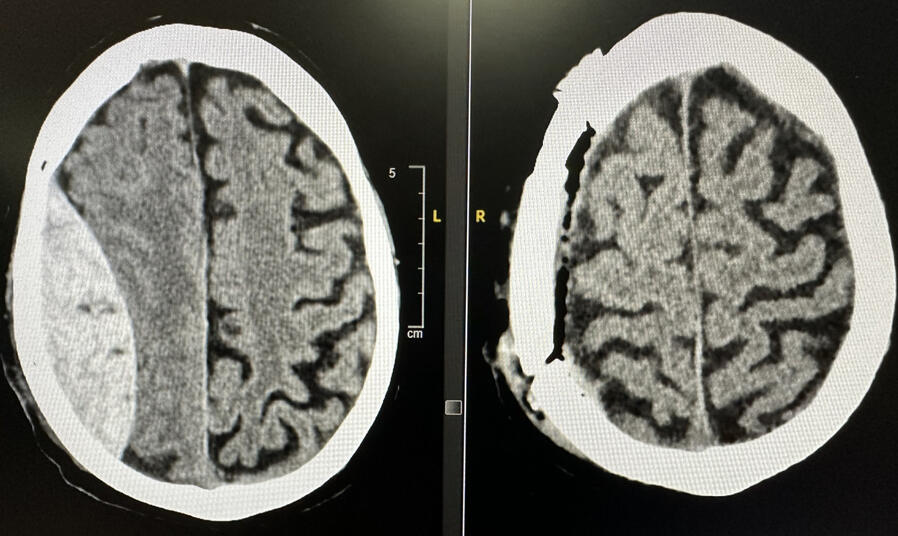 La Sociedad Española de Neurocirugía (SENEC) NEUROCIRUJANO ALICANTE